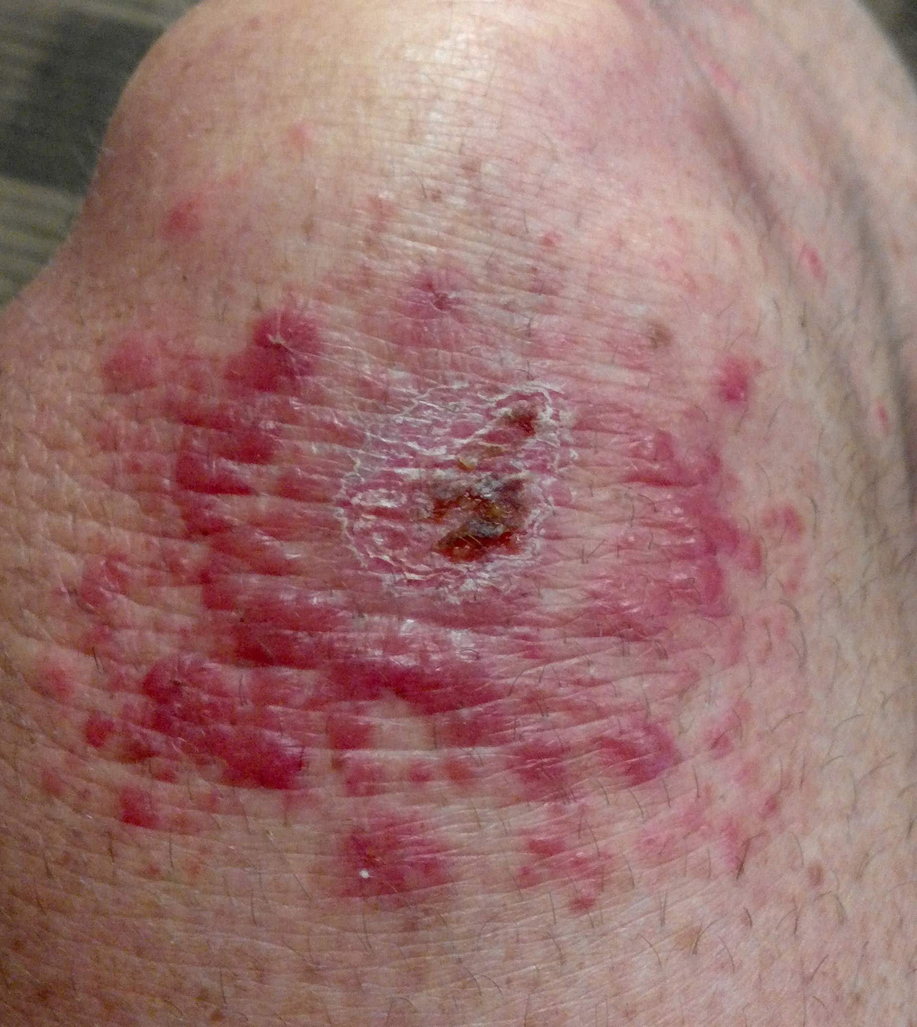 knee